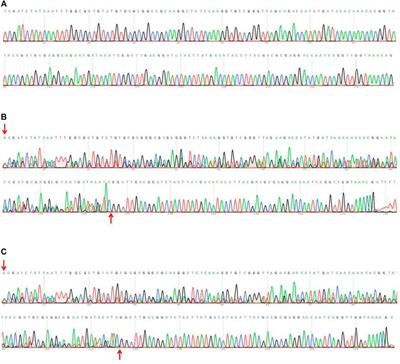 First Report on CRISPR/Cas9-Based Genome Editing in the Destructive Invasive Pest Tuta Absoluta (Meyrick) (Lepidoptera: Gelechiidae)